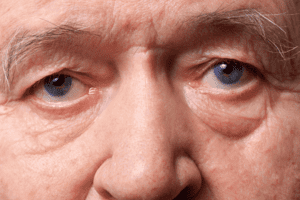 NHỮNG DẤU HIỆU LÃO HÓA MẮT & CÁCH CHĂM SÓC HIỆU QUẢ