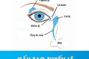 Tắc tuyến lệ: Để nhận biết và cách xử lý